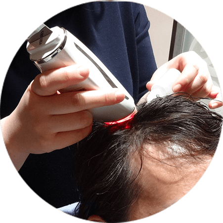 メセル発毛HCRコース